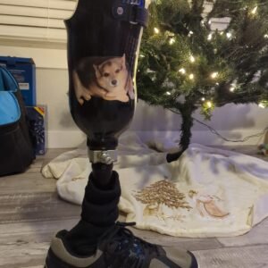 prosthetic leg