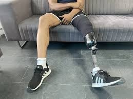 You are currently viewing Lightweight Prosthetic Leg